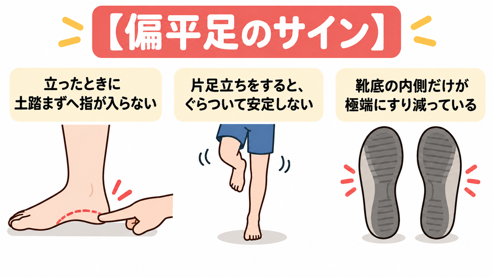 偏平足 サイン