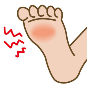 足底筋膜炎 原因と対処法 ほねごりチェーン